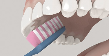 Le brossage des dents