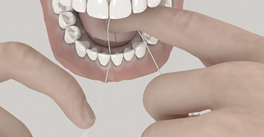 L'utilisation du fil dentaire